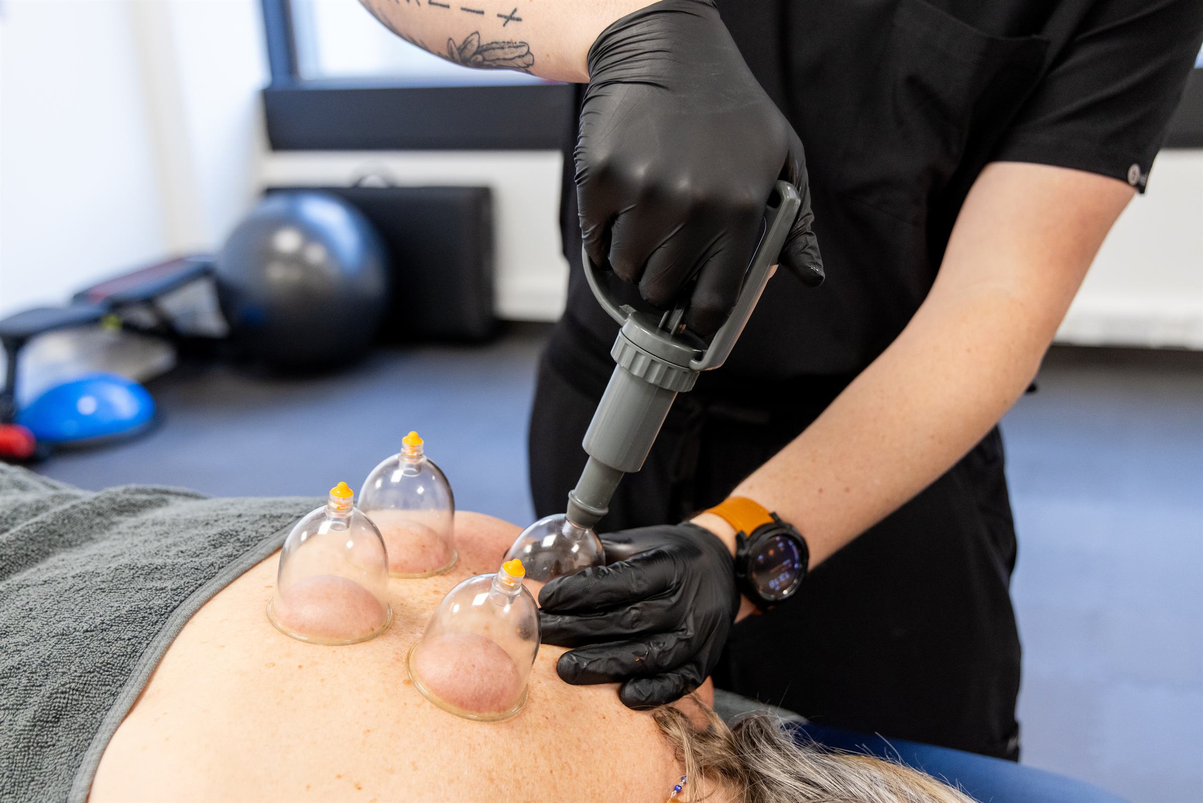 Cupping Therapy